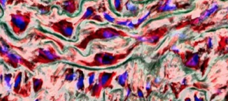 Un estudio descubre una nueva causa de los aneurismas en la aorta y una posible vía para prevenirlos sin cirugía