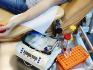 Tres hospitales públicos madrileños, elegidos como centros nacionales para obtener células madre destinadas a trasplante de médula