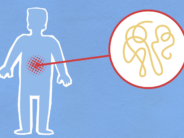 Logran un prometedor avance para la enfermedad inflamatoria intestinal gracias al uso de virus