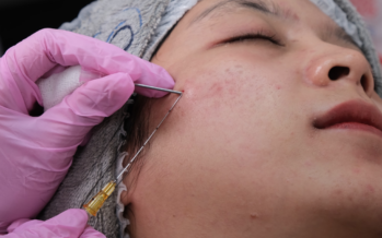 Los estimuladores de grasa a partir de cadáveres esperan evidencia a nivel facial para llegar a España